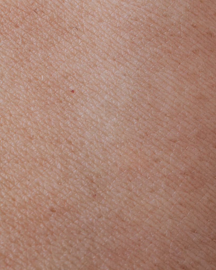 Close-up of dry, flaky facial skin needing hydration