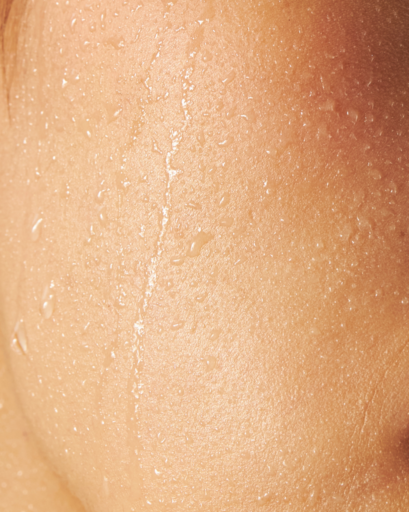 Woman touching her cheek showing visible dryness and tightness